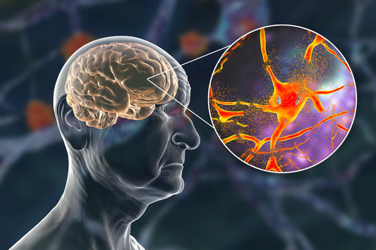 World Alzheimer’s Month: Keep Your Mind Sharp with These Activities